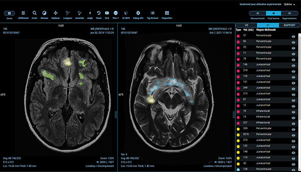 AI-powered medical imaging
